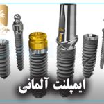 ایمپلنت آلمانی