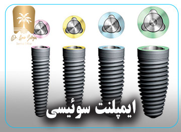ایمپلنت سوئیسی