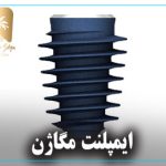 ایمپلنت مگاژن دندان