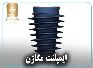 ایمپلنت مگاژن دندان