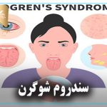سندروم شوگرن