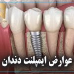 عوارض ایمپلنت دندان