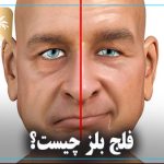 فلج بلز