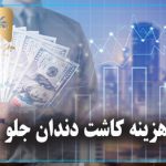 هزینه کاشت دندان جلو