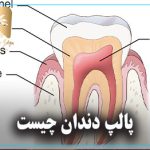 پالپ دندان چیست