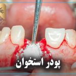 پودر استخوان