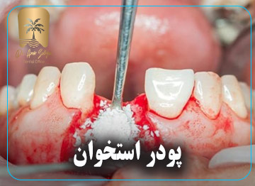 پودر استخوان