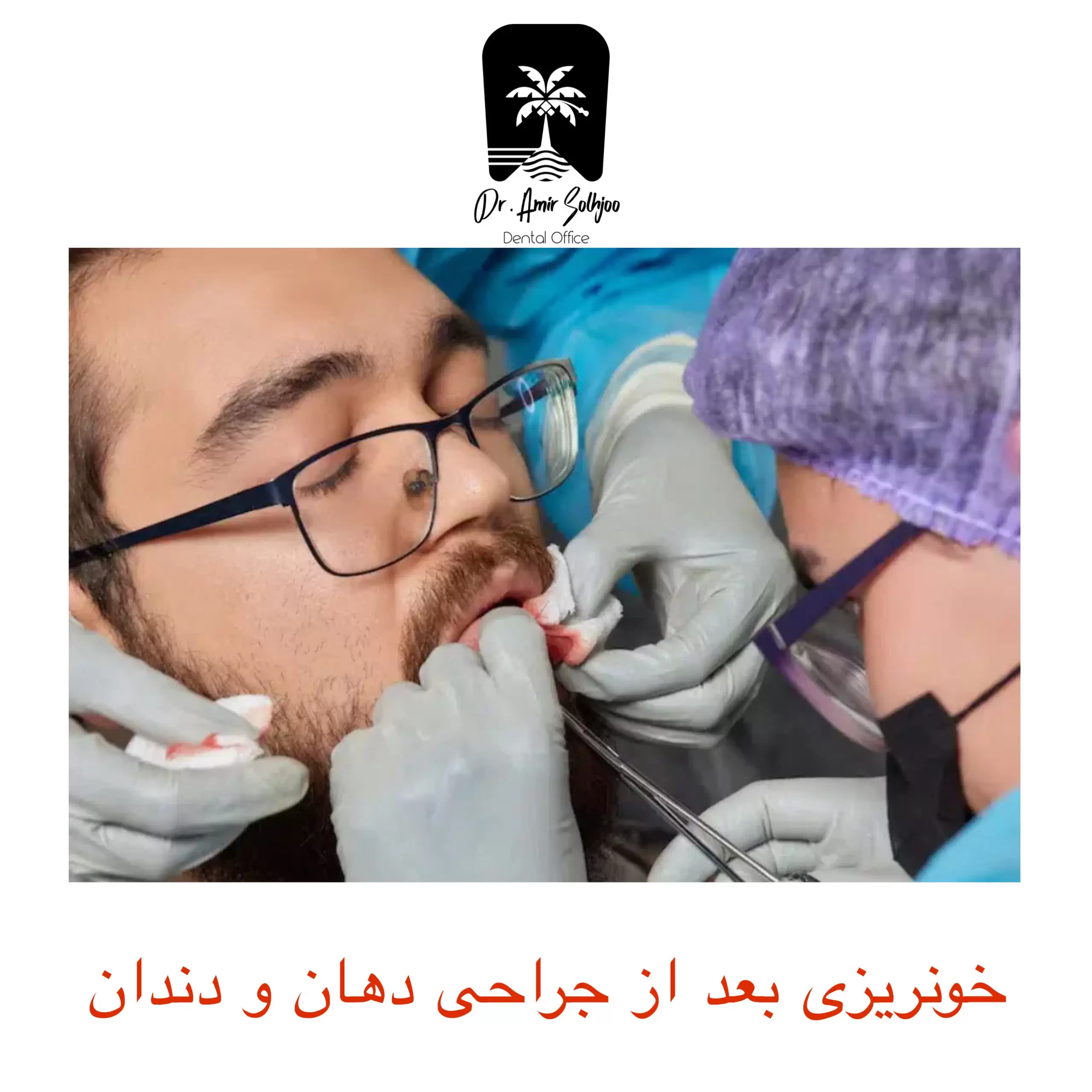 خونریزی بعد از جراحی
