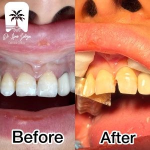 دندانپزشکی فعال در تعطیلات رسمی 1404