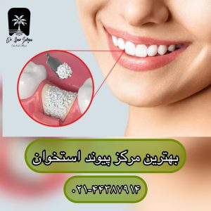 بهترین مرکز پیوند استخوان در تهران