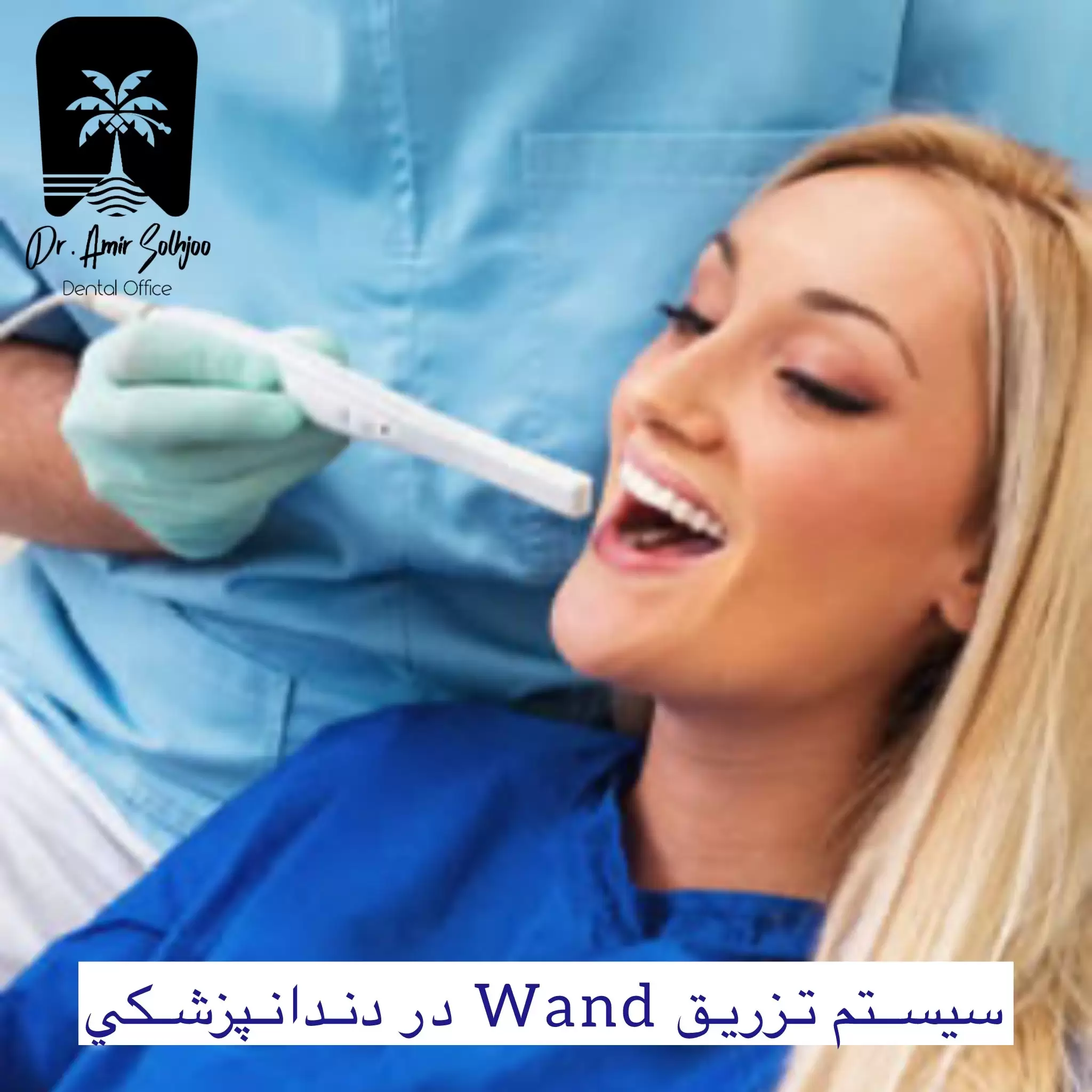 سیستم تزریق wand