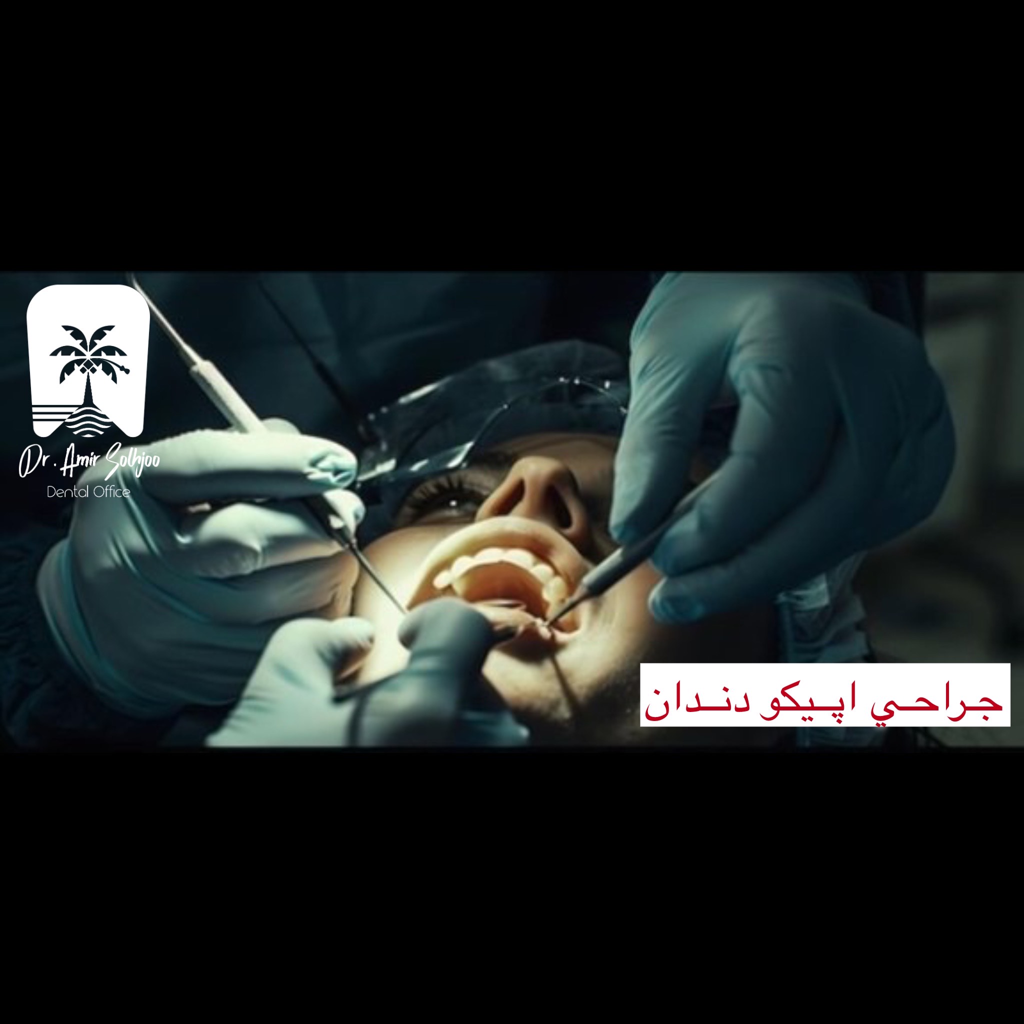 جراحی اپیکو