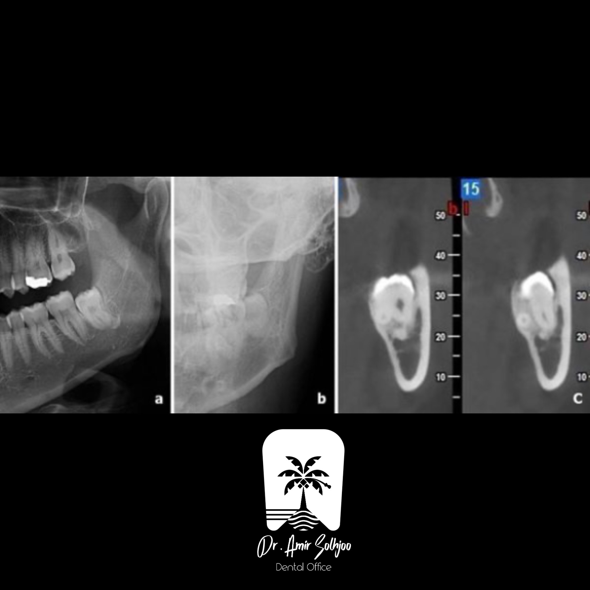 تفاوت عکس cbct و opg