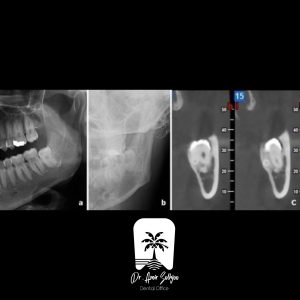 تفاوت عکس cbct و opg