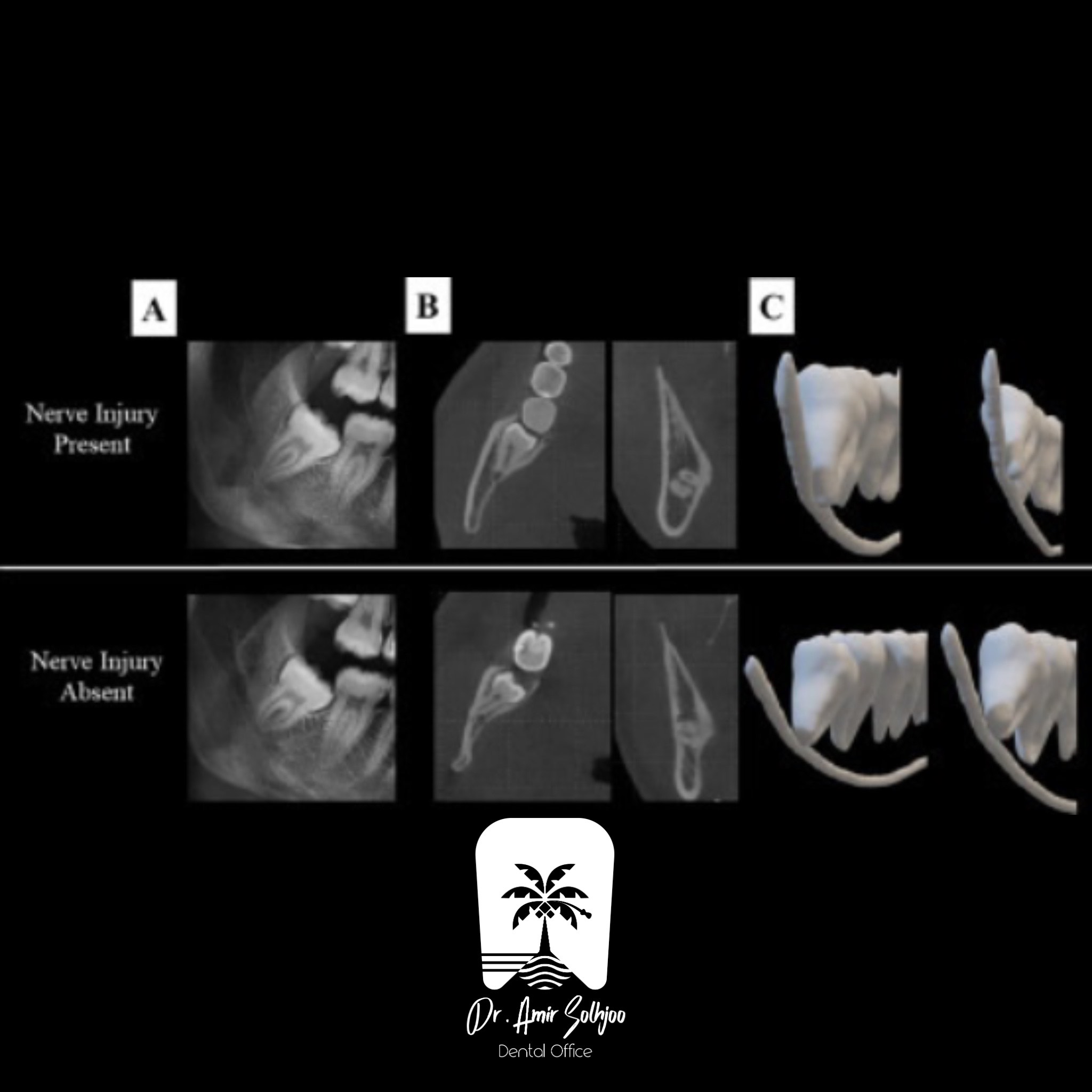 cbct و opg چیست