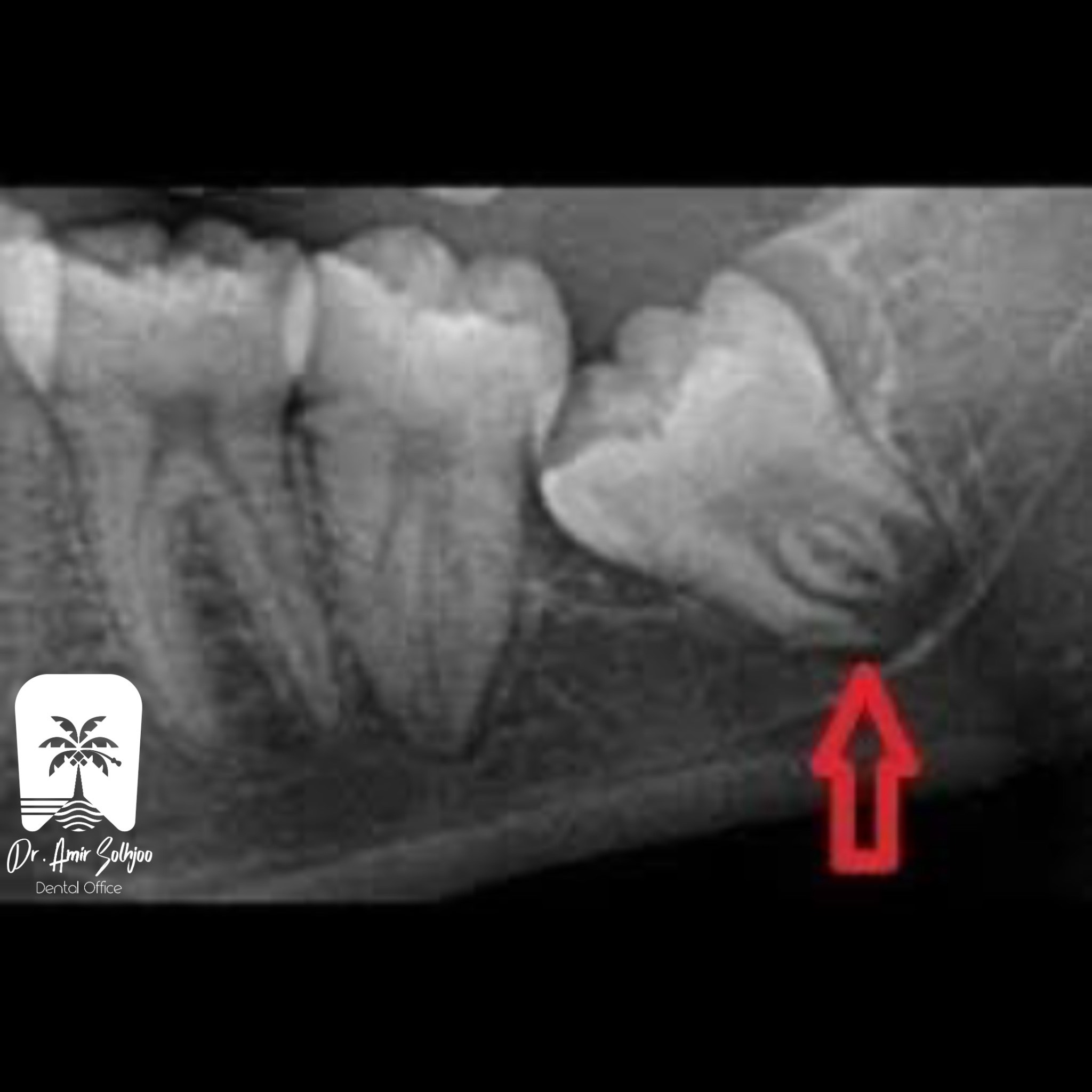تفاوت عکس cbct و opg