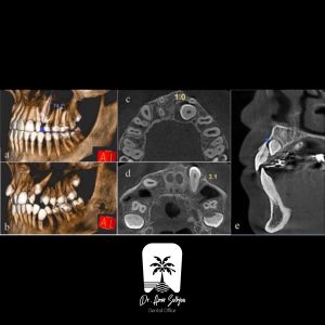 تفاوت عکس cbct و opg