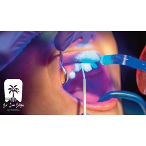راحتی و سهولت در استفاده فلوراید تراپی