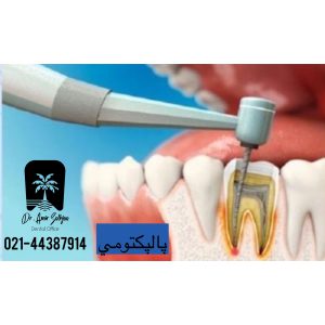 پالپکتومی دندان بزرگسالان