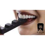 بهترین رنگ لمینت دندان