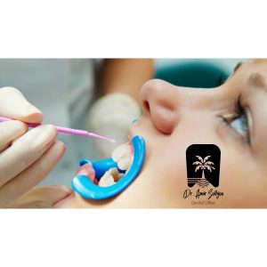 مزایای فلوراید تراپی