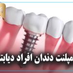 ایمپلنت دندان افراد دیابتی