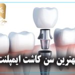 بهترین سن کاشت ایمپلنت