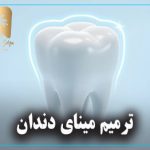 ترمیم مینای دندان