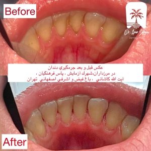 بهترین مرکز جرمگیری دندان