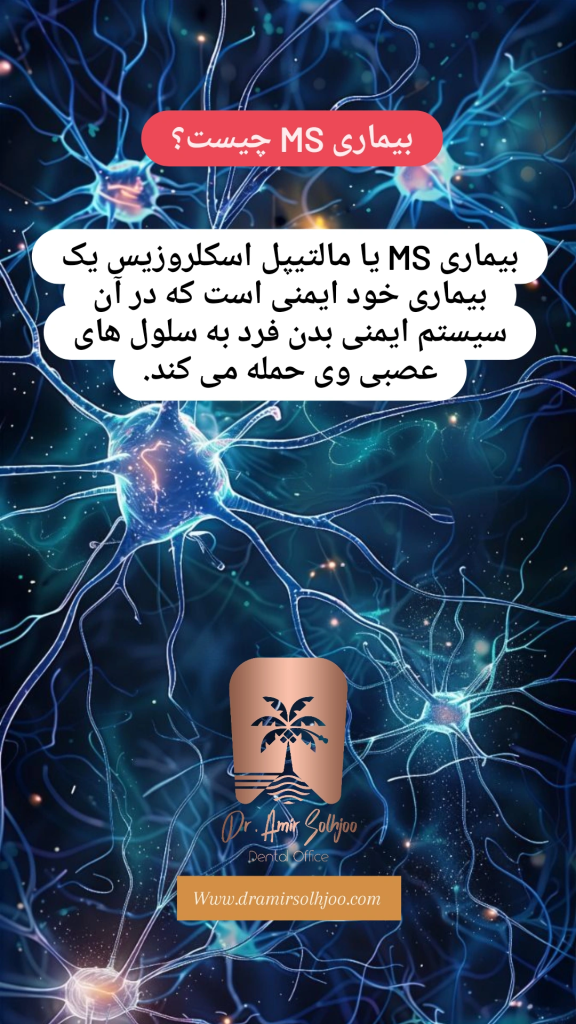 بیماری ms چیست؟
