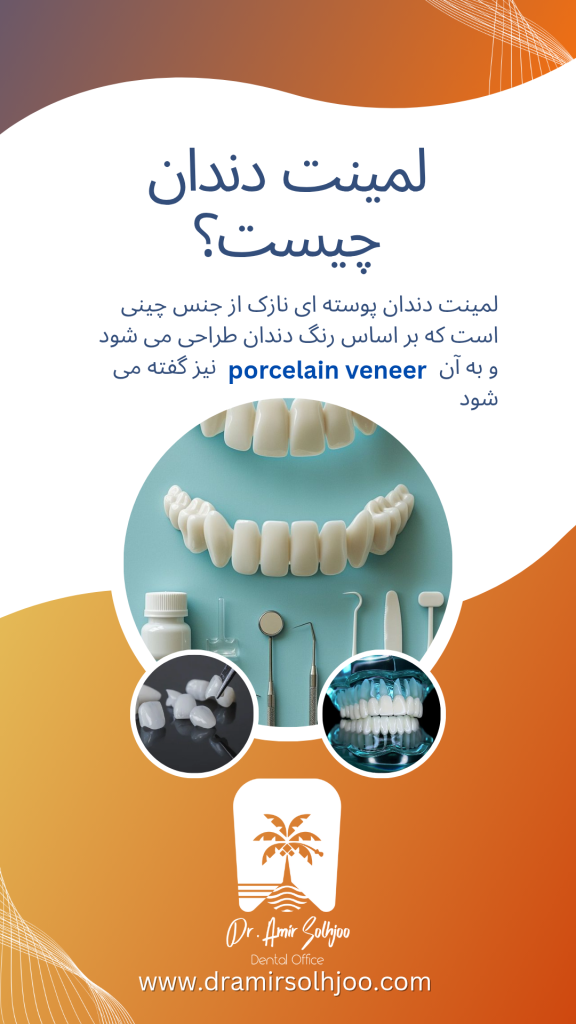 لمینت دندان چیست