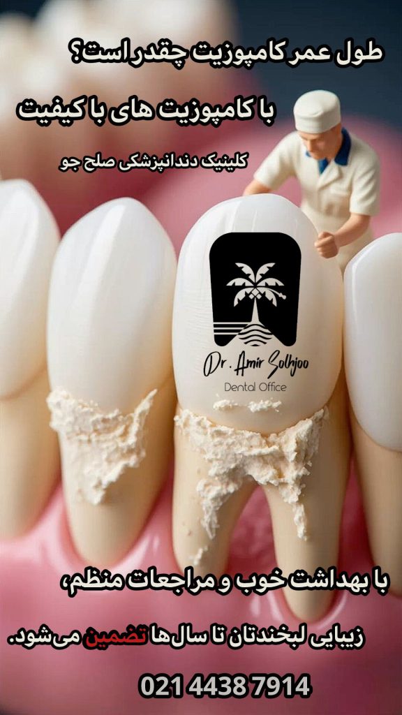 طول عمر کامپوزیت چقدر است؟
