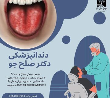 سندرم سوزش دهان