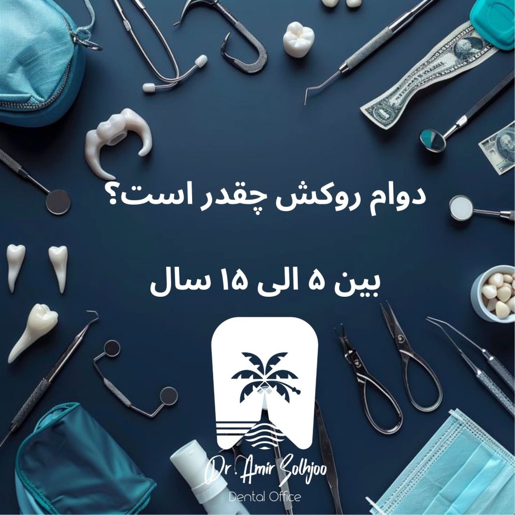 دوام روکش دندان