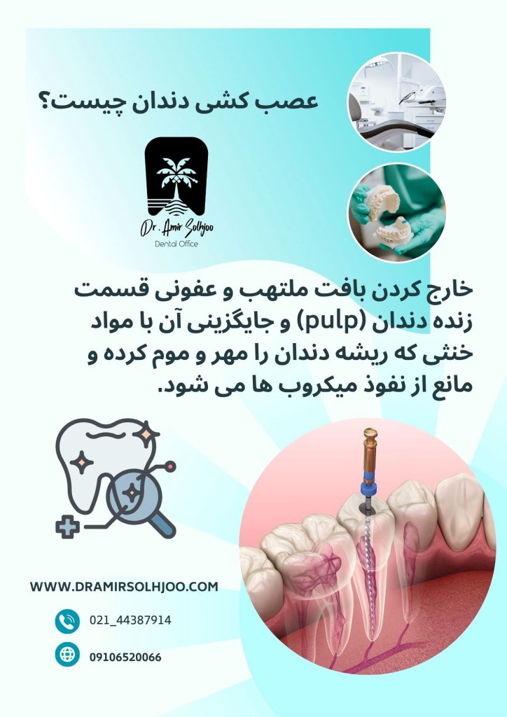 عصب کشی