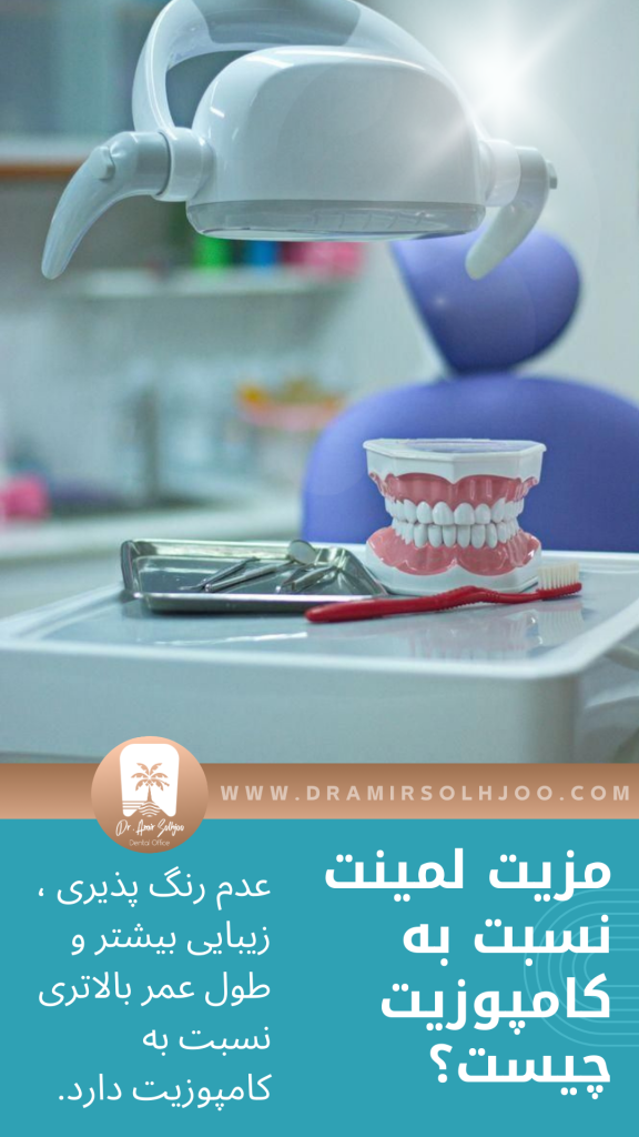 مزایای لمینت دندان قسطی نسبت به کامپوزیت