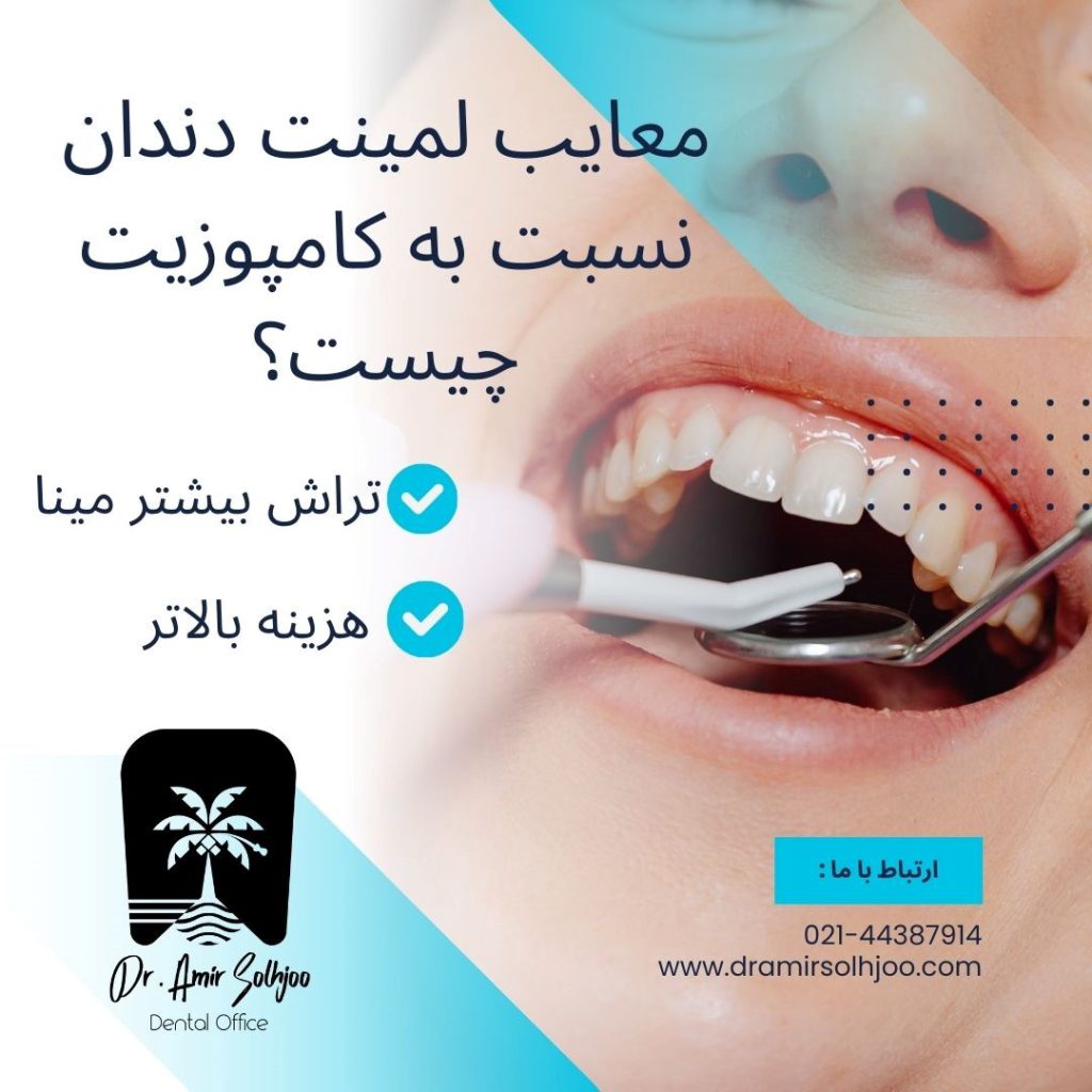 معایب لمینت دندان نسبت به کامپوزیت