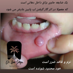 موکوسل