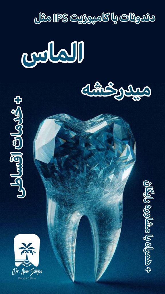 بهترین برند کامپوزیت آلمانی اقساطی