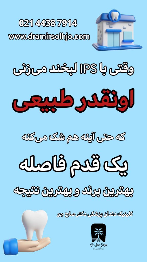کامپوزیت ips
