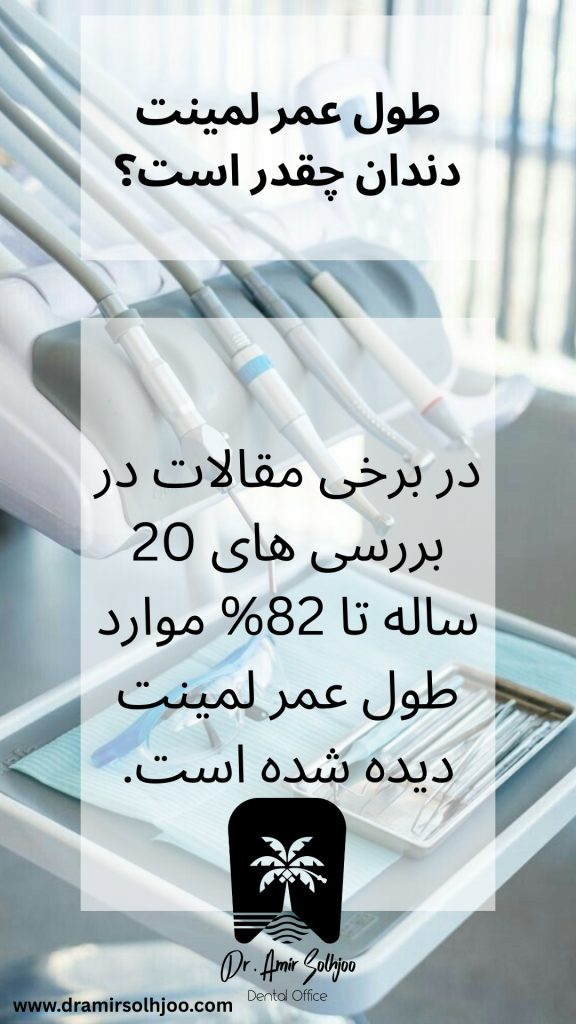طول عمر لمینت دندان چقدر است؟
