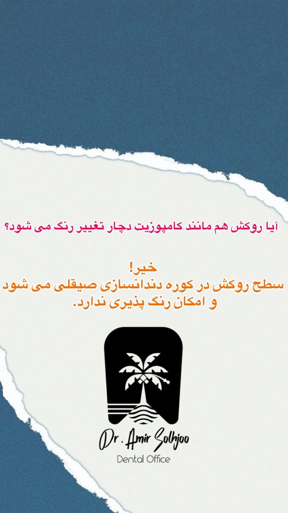 تغییر رنگ روکش دندان