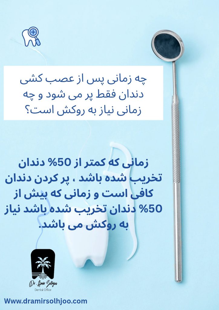 قیمت عصب کشی و پرکردن دندان ۱۴۰۴