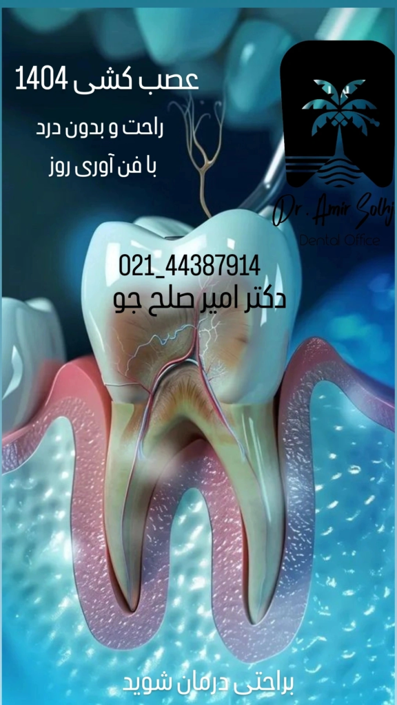 عصب کشی 1404
