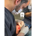مرکز ایمپلنت مرزداران حوالی شهرک غرب