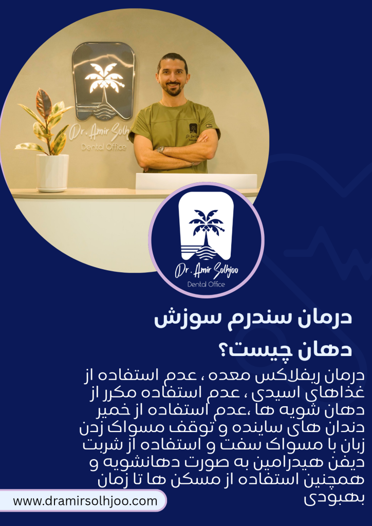 درمان سندرم سوزش دهان