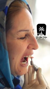 نمونه رنگ کامپوزیت