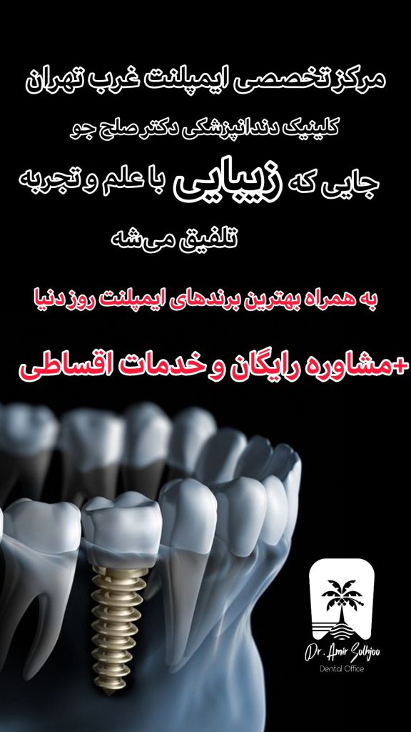 مرکز تخصصی ایمپلنت غرب تهران