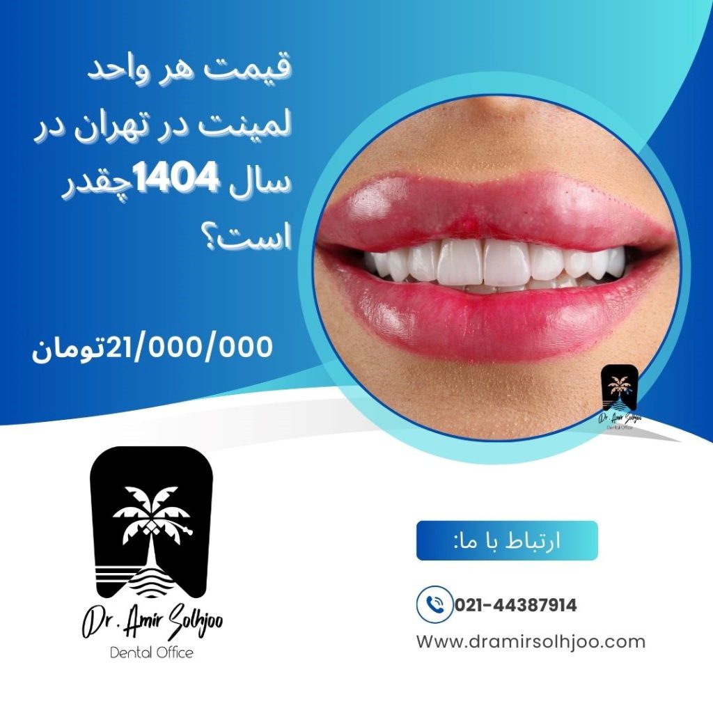 قیمت هر واحد لمینت در تهران سال 1404