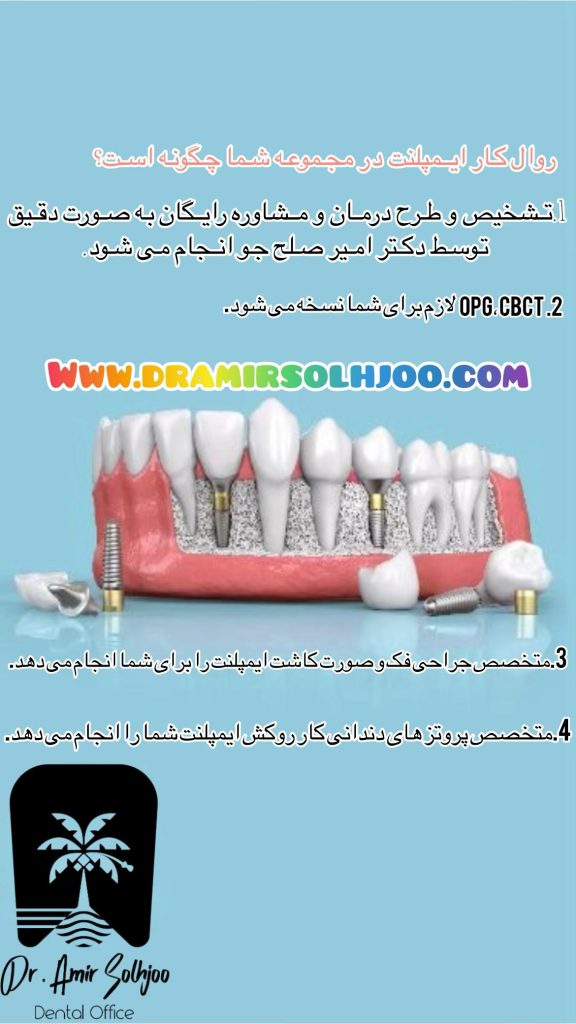 کلینیک ایمپلنت خوب در شهرک غرب و سعادت آباد